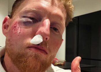 Ben Stokes Seriously Injured After Being Hit by Ball